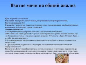 Алгоритм забор мочи на общий анализ