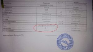 Анализ мочи на суточные соли