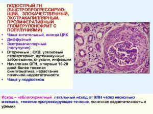 Аутоиммунный гломерулонефрит прогноз