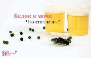 Белок в моче понижен что это значит