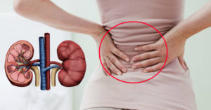 Болят почки после тяжелого