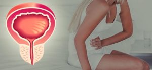 Частое мочеиспускание при месячных причины