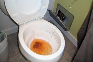 Что делать если писаешь кровью