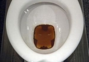 Что делать если писаешь кровью