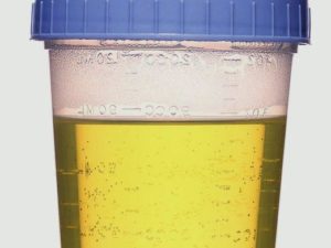 Что такое моча