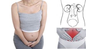 Цистит в начале беременности