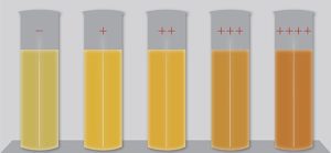 Цвет мочи на ранних сроках беременности