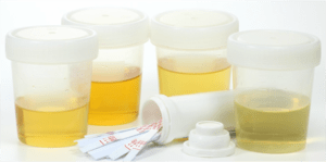 Цвет мочи на ранних сроках беременности