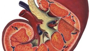 Дилатация члс почки что это такое