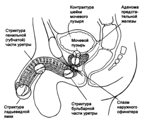 Где находится уретра у мужчин