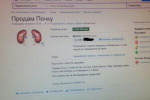 Где продать почку и сколько стоит