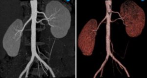 Где сделать кт почек в волгограде