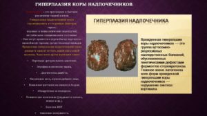 Гиперплазия коры надпочечников