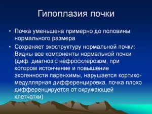 Гипоплазия правой почки у ребенка лечение