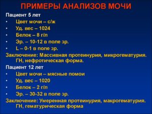 Гломерулонефрит показатели анализов