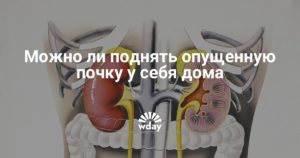 Как поднимать почку