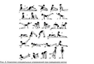 Как поднимать почку