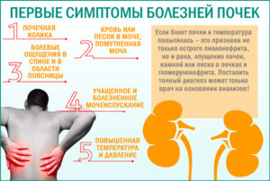Как понять что болят почки