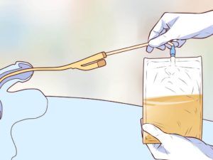 Как вставляется в почку катетер