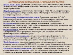 Какие анализы сдают при мочекаменной болезни