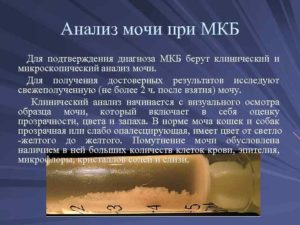 Какие анализы сдают при мочекаменной болезни