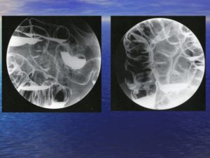 Контрастные вещества в рентгенологии