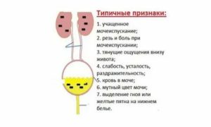 Кровь после мочеиспускания у женщин с болью