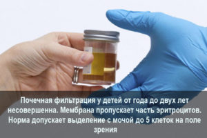 Кровь в моче у ребенка 6 лет