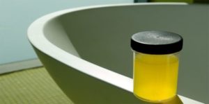 Липкая моча у мужчин причины