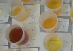 Липкая моча у мужчин причины