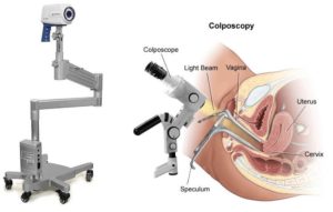 Микроскопия что это такое в гинекологии