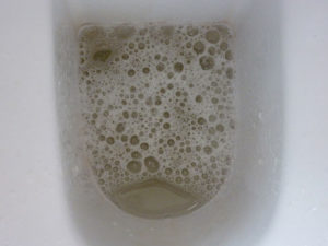 Моча с пеной у мужчин