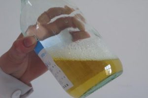 Моча с пеной у мужчин