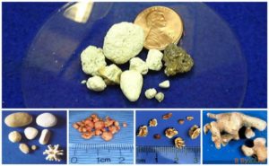 Мочегонное для кота камни в почках