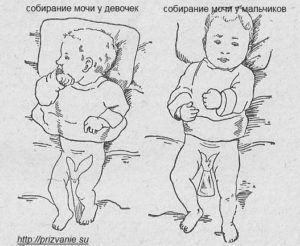 Можно ли собирать мочу ребенка с вечера