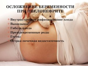 Можно ли забеременеть при пиелонефрите