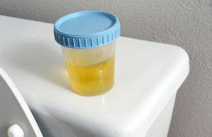 Мутная моча при орви у ребенка