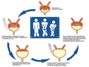 Недержание мочи у мужчин после 50 лет причины