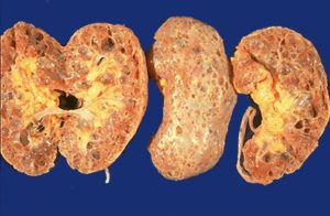 Нефрит у кошки лечение