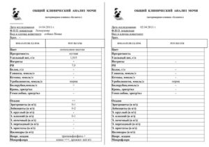 Общий анализ мочи у детей что показывает