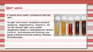 Окрашивающие мочу продукты