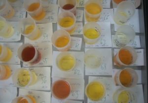 Определить заболевание по цвету мочи