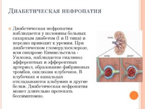 Осложнения на почки при сахарном диабете 2 типа