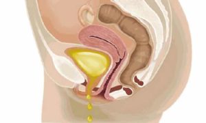 Откуда течет моча