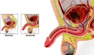 Откуда течет моча