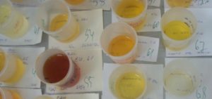 Отличается ли женская моча от мужской при анализе