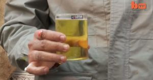 Пена в моче у мужчин