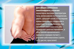 Пиелонефрит почек симптомы у мужчин