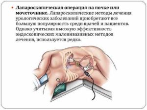 Питание после лапароскопии кисты почки