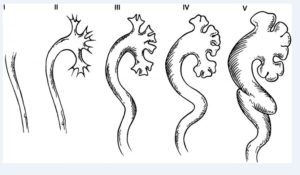 Пмр в медицине